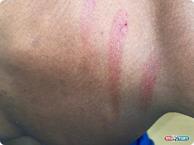 גופו של יבואה (דף הפייסבוק הפועל באקה אל גרבייה)